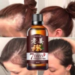 Fast Hair Growth Dense Regrowth Ginger Serum Oil Anti Loss Treatment