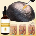 Biotin Fast Hair Growth Oil For Men woman Hair Treatment Baldness Serum Anti-Hair Loss Hair Regrowth Liquid