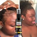 Hair Growth Oil for Black Women Serum Thick Long Hair Powerful Beard Growth Serum