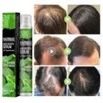 Hair Growth Products For Men Women Hair Loss Treatment Fast Grow Hair Spray Regrowth Thicken Oil Hair Care