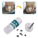 Toenail Corrector Tools Pedicure Recover Embed Toe Nail Treatment Professional Ingrown Toenail Straightening Clip Brace