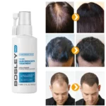 Hair Growth Serum Spray Fast Hair Growth Liquid Treatment Scalp Hair Follicle Anti Hair Loss Natural Beauty Health