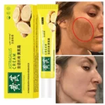 Whitening Cream Remove Melasma Freckles Fade Dark Spot Astragalus Remove Dark Yellow Skin Brighten Anti-aging