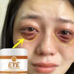 Dark Circles Cream And Eye Bags Removal Puffiness Away Work Under Eyes