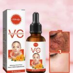 Dark Spot Remover Serum For Face Freckles Melasma Chloasma Age Spots Removal