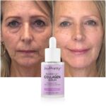 Collagen Face Serum Wrinkle Removal Anti Aging Hyaluronic Acid Forehead Fine Lines Lifting Facial Serum Skin Care Beauty