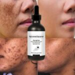 Nature Whitening Face Serum Turmeric Oil Brighten Removal Pigment Melanin Correcting Essence Beauty Skin Care