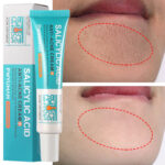 Acid Night Cream Clean Pores Exfoliation Gel Reduce Redness Acne Marks Pigmentation Oil Control Repair Face Skin Care