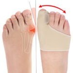 Women Men Toe Separator Hallux Valgus Bunion Corrector Orthotics Feet Thumb Adjuster Correction Pedicure Socks Toe