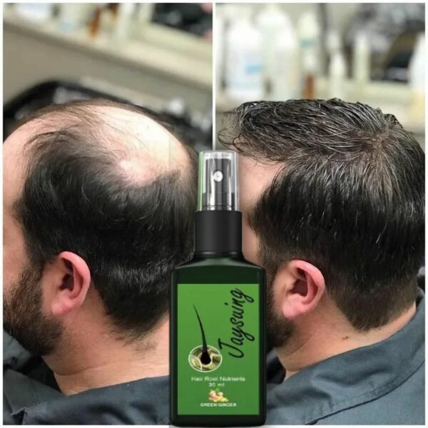Hairrebirth Herbal Spray Regrowth Nourishing Ginger Oil Serum Promote Quickly Grow Thick Hair Growth