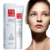 Improve Freckle Whiten Cream Effective Dullness Remove Dark Spot Melasma Fade Melanin Anti-pigmentation Brighten Face Skin Care