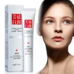 Improve Freckle Whiten Cream Effective Dullness Remove Dark Spot Melasma Fade Melanin Anti-pigmentation Brighten Face Skin Care