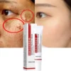 Face Dark Spots Remover for Women Remove Melasma Freckles Cream Removal Melanin Whitening Cream Fade Spots Skin