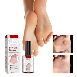 Foot Corns Removal Gel  Medicine Exfoliating Repair To Remove Sharp and Sharp Chicken Eye Liquid Meat Ball
