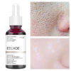 Serum Face Removing Large Pores Tightening Repairing Facial Pore Minimizing Essence Skin Care Beauty