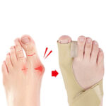 Toe Separator Hallux Valgus Bunion Corrector Orthotics Feet Bone Thumb Adjuster Correction Pedicure Sock Straightener