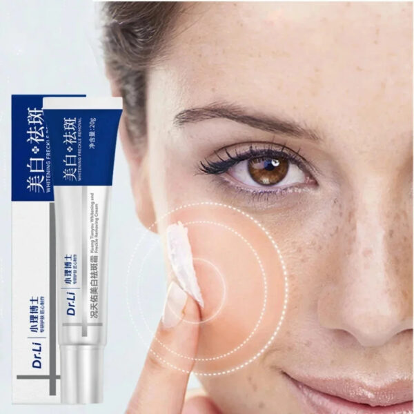 Whitening Freckle Cream Effective Remove Melasma Dark Spots Cream Fade Melanin Moisturize Brighten Smooth Beauty Face Skin Care