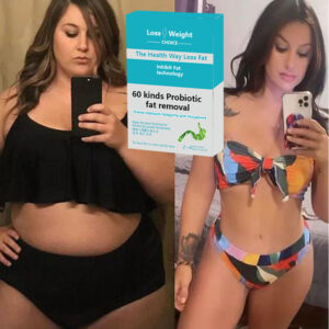 Beauty Burning Fat Slimming Losing Weight Cellulite Body Belly Waist Fat Burner Navel Chinese Medicine healthy fast