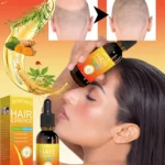 Hair Growth Oil Hair Loss Treatment Rapid Hair Growth Effective Baldness Repair Hereditary Postpartum Loss