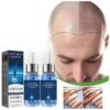 Fast Hair Growth Essence Oil Products Effective Baldness Repair Treatment Anti Hereditary Seborrheic Alopecia Loss For Men Women