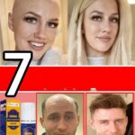 Hair Growth Spray Products for Men and Women, Ginger Anti-hair Loss, Rapid Regeneration,Thickening, Oil Control,