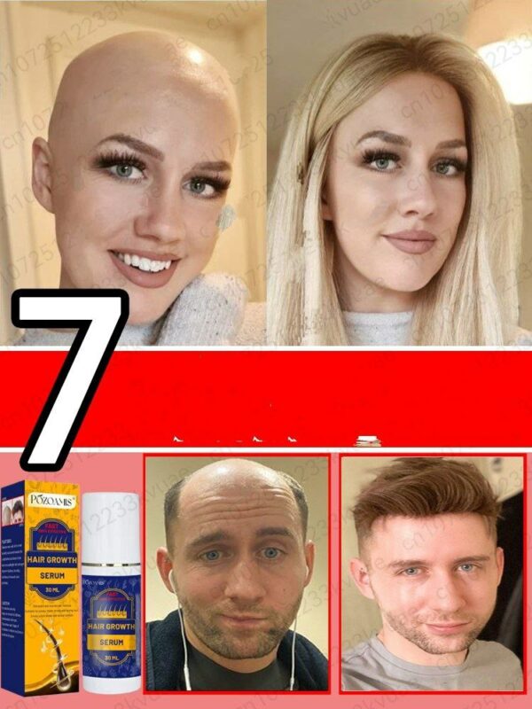 Hair Growth Spray Products for Men and Women, Ginger Anti-hair Loss, Rapid Regeneration,Thickening, Oil Control,
