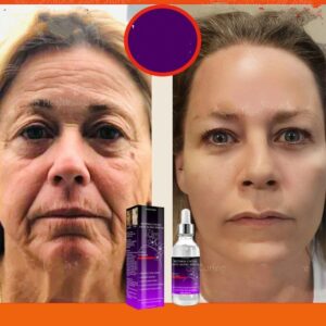Anti-Ageing Serum Effective Anti-Wrinkle Remove Facial Wrinkles Fine Lines Around Eyes Crow's Feet Neck Wrinkl