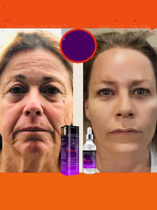 Anti-Ageing Serum Effective Anti-Wrinkle Remove Facial Wrinkles Fine Lines Around Eyes Crow's Feet Neck Wrinkl