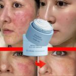 Effective Facial Redness Repair Cream Rosacea Treat Sensitive Skin Dryness Moisturizer Hydrating Sooth Lotion