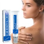 Scar Cream Fast Removal Skin Scars Treat Surgery Scars Stretch Marks Acne Pox Prints Burn Repair Facial Care Gel