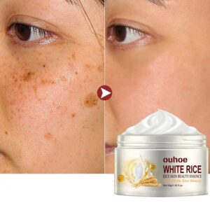 Rice Whitening Face Cream Anti Wrinkle Fade Fine Lines Gel Remove Melanin Improve Dullness Moisturizing Brighten