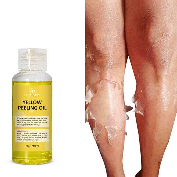 Skin Peeling Oil Super Strength Body Peeling Oil Brightening Skin Tone Moisturizing Skin Care Exfoliating Yellow Oil
