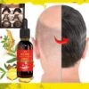 Rapid Hair Growth Essential Oil, Repair Baldness