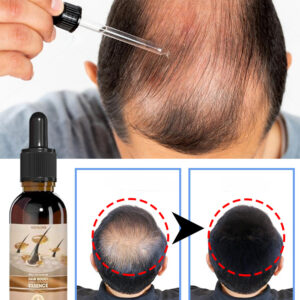Unisex Hair Growth Oil Hair Loss Treatment Rapid Hair Growth Effective Baldness Repair Hereditary Postpartum Hair Loss