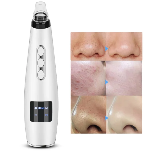 Blackhead Remover Vacuum, Electric Facial Comedo Suction Pore Cleaner Extractor Tool,Replaceable Suction Heads