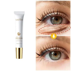 Remove Freckle Cream Whitening Dark Spots Effective Remove Melasma Serum Melanin Moisturize Brighten Smooth Face Skin Care