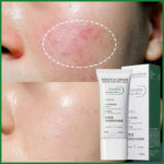 Fast Repair Facial Redness Cream Sooth Itching Sensitive Skin Improve Rosacea Remove Acne Nourish Facial Skin Korean