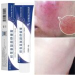 Facial Redness Cream Soothing Red Blood Rosacea Treatment Improve Sensitive Skin Moisturizer Skin Care Cosmetics