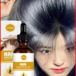Fast Hair Growth Hair Growth Oil Effective Baldness Repair Hereditary Hair Loss Postpartum Hair Loss Seborrheic Hair Anti Loss
