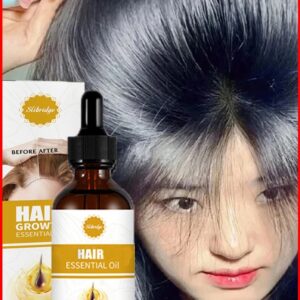 Fast Hair Growth Hair Growth Oil Effective Baldness Repair Hereditary Hair Loss Postpartum Hair Loss Seborrheic Hair Anti Loss