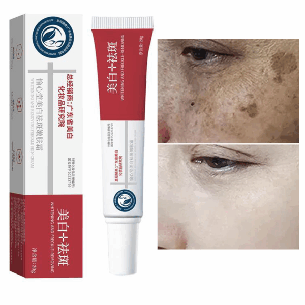 Freckle Whiten Cream Effective Removing Spot Eliminate Brown Stain Melasma Melanin Blemishes Lighten Moisturiser