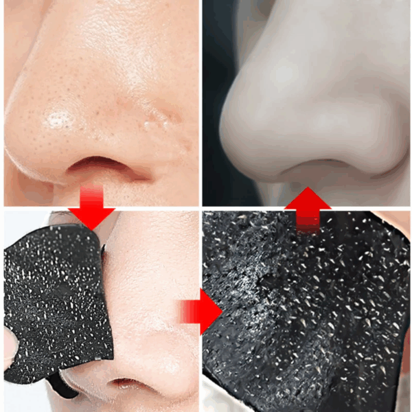 White Blackhead Remover Nose Mask Pore Strip Black Masks Peeling Acne Treatment Face Deep Cleansing Skin Care
