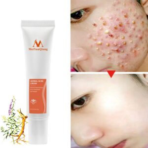 Acne Cream Acne Removal Eliminate Acne Marks Repair Damaged Skin Moisturizing Nourishing Whitening Skin Rejuvenating Face Care
