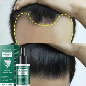 Fast Hair Growth Serum Anti Hair Loss Scalp Treatment Grow Products Nourishing Repair Damaged Hair Root Beauty Health Hair Care