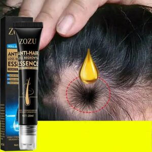Fast Hair Growth Essence Effective Anti Hair Loss Serum Baldness Repair Hereditary Postpartum Seborrheic Hair Loss Hair Care