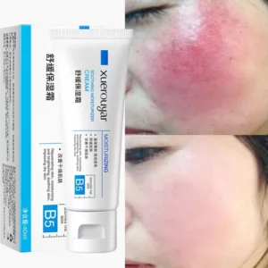 Instant Rosacea Treatment Face Cream Repair Redness Dry Sensitive Skin Improve Red Blood Cellulite Sooth Lotion Korean Cosmetics