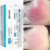 Facial Redness Repair Cream Improve Dry Sensitive Skin Repair Rosacea Itching Acne Face Moisturizer Sooth Korean Care Products