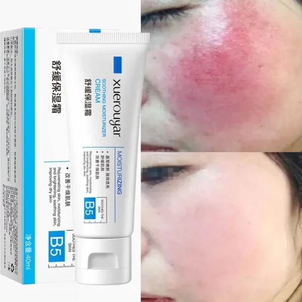 Facial Redness Repair Cream Improve Dry Sensitive Skin Repair Rosacea Itching Acne Face Moisturizer Sooth Korean Care Products