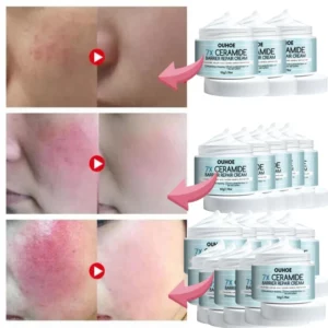 7 Day Face Rosacea Treatment Cream Collagen Intense Repair Redness Dry Sensitive Itching Skin Moisturize