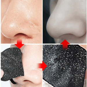 Blackhead Remover Nose Mask Pore Strips Peeling Acne Treatment Deep Cleansing Face Mask Oil Control Pores Shrinking Skin Care